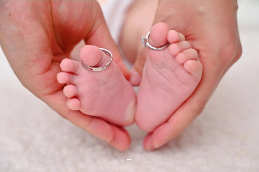 莆田孕妇怎样预防妊娠纹